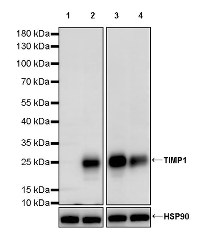 TIMP1 Recombinant Rabbit mAb (S-5147)