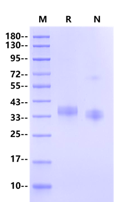 Spike RBD His Tag Protein, SARS-CoV-2(BA.2/Omicron)