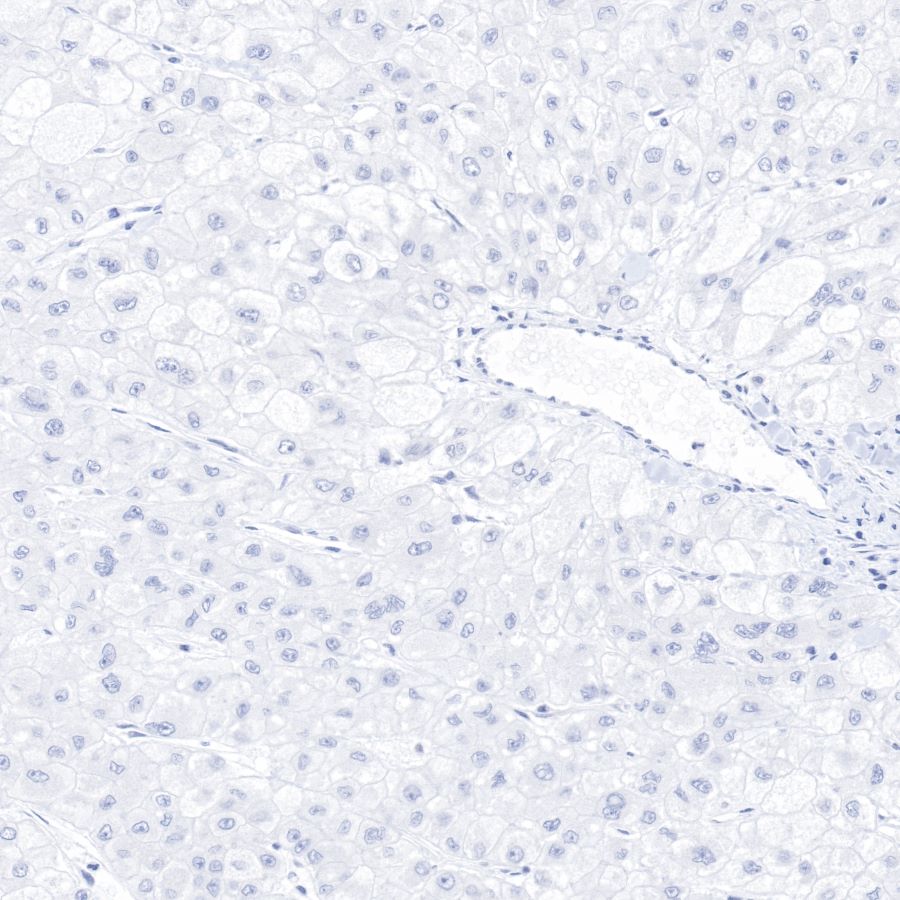 Keratin 20 Recombinant Rabbit mAb (SDT-013-18)