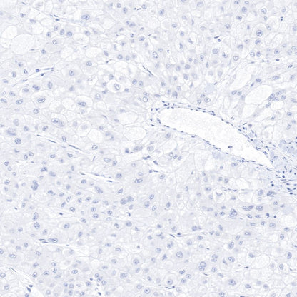 Keratin 20 Recombinant Rabbit mAb (SDT-013-18)