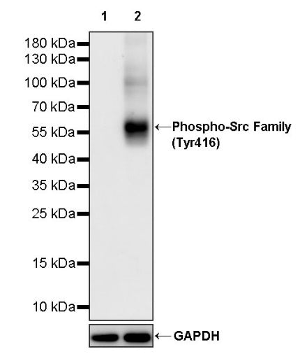 Phospho-Src Family (Tyr416) Recombinant Rabbit mAb (S-1556-29)