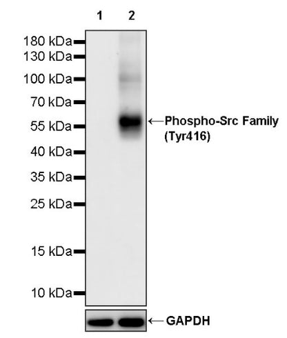 Phospho-Src Family (Tyr416) Recombinant Rabbit mAb (S-1556-29)