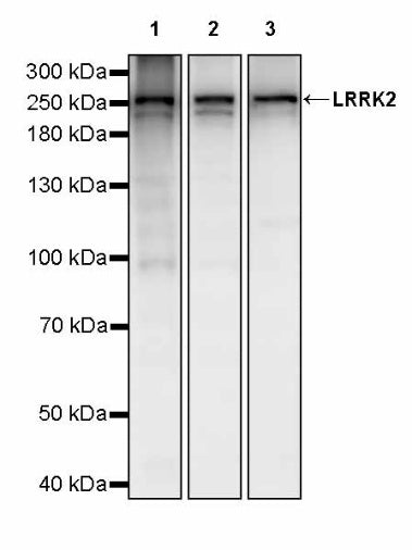 LRRK2 Recombinant Rabbit mAb (S-2484-164)