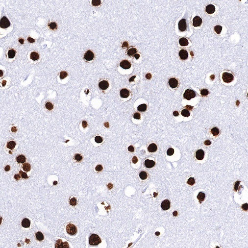Histone H3 (tri methyl K27) Recombinant Rabbit mAb (SDT-431-118)