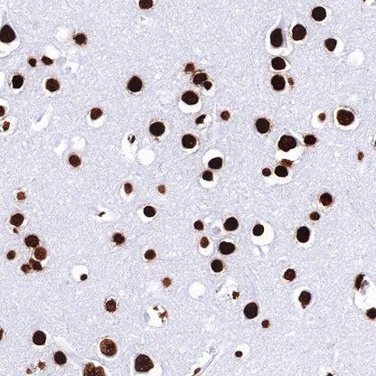 Histone H3 (tri methyl K27) Recombinant Rabbit mAb (SDT-431-118)