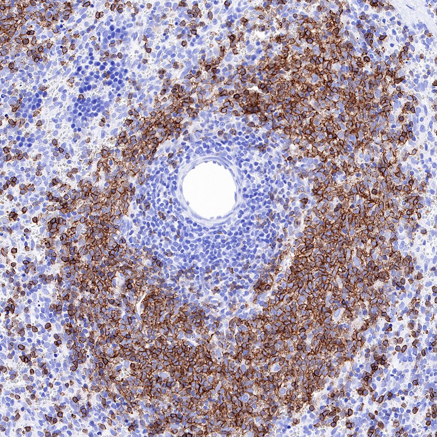 S-RMab® CD20 Recombinant Rabbit mAb,PBS Only (SDT-R133)
