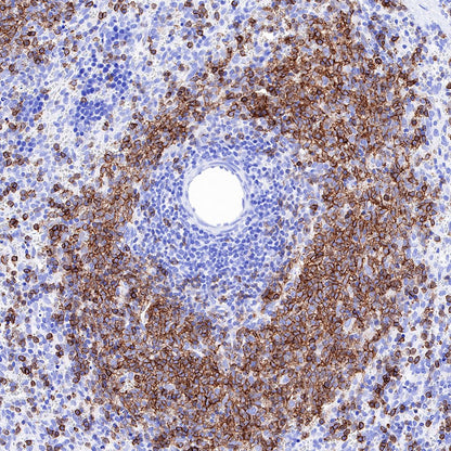 S-RMab® CD20 Recombinant Rabbit mAb,PBS Only (SDT-R133)