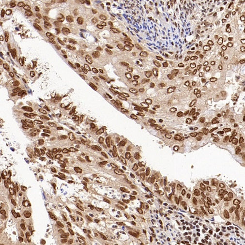 XPO1/CRM1 Recombinant Rabbit mAb (S-3309-7)