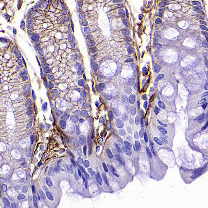 PTK7 Recombinant Rabbit mAb (SDT-2432-156)
