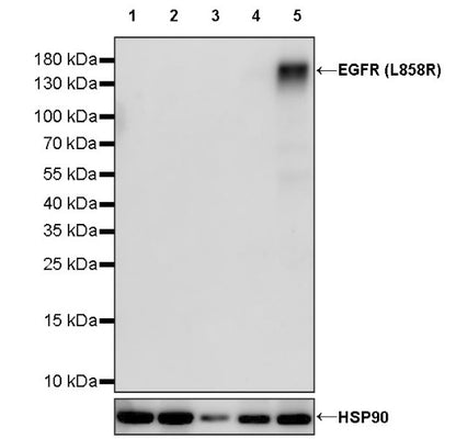 EGFR (L858R) Recombinant Rabbit mAb (SDT-421-202)