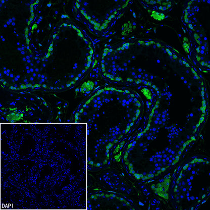 PGP9.5 Recombinant Mouse mAb (S-6071)