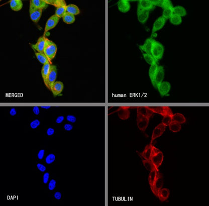Erk1/2 Recombinant Rabbit mAb (S-3178)