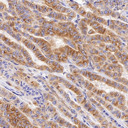 Beta I tubulin Recombinant Rabbit mAb (S-3108-63)