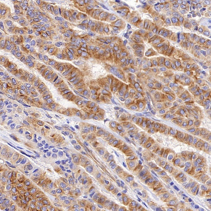 Beta I tubulin Recombinant Rabbit mAb (S-3108-63)