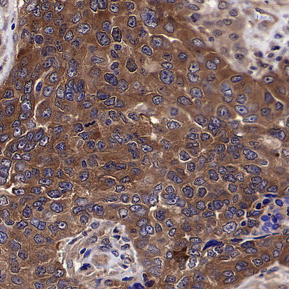 HSP90 Recombinant Mouse mAb (S-5484)