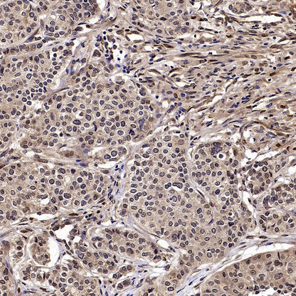 SEK1/MKK4 Rabbit Polyclonal Antibody