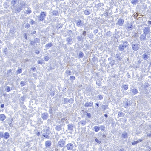 CD86 Recombinant Rabbit mAb (S-4222)