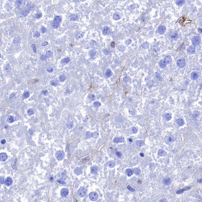 CD86 Recombinant Rabbit mAb (S-4222)