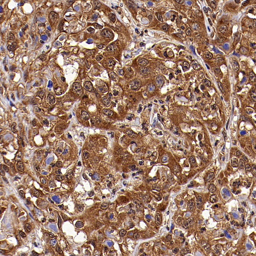 PLCG1 Recombinant Rabbit mAb (S-978-37)