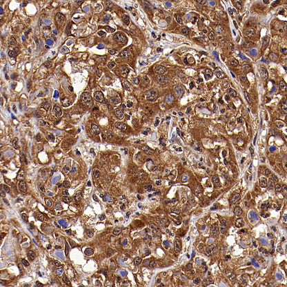 PLCG1 Recombinant Rabbit mAb (S-978-37)