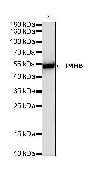 P4HB Recombinant Rabbit mAb