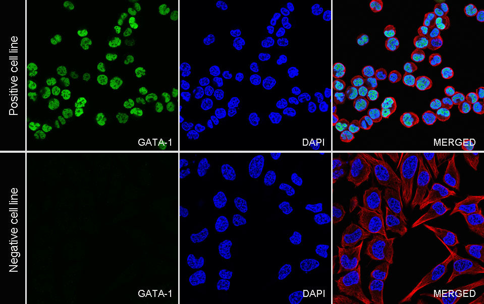 GATA1 Recombinant Rabbit mAb (S-5401)