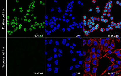 GATA1 Recombinant Rabbit mAb (S-5401)