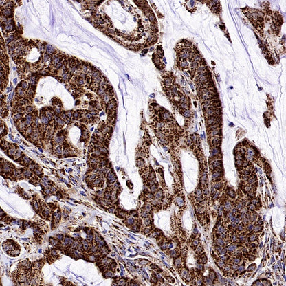 Fumarate hydratase Recombinant Rabbit mAb (SDT-2394-36)