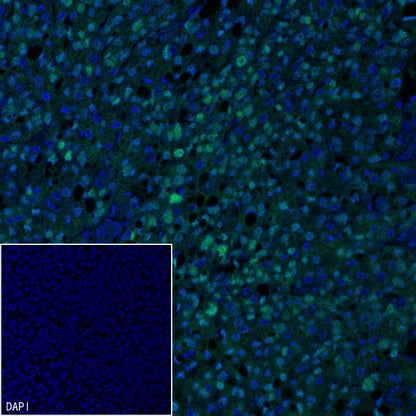 Brachyury Recombinant Rabbit mAb (SDT-1926-107)
