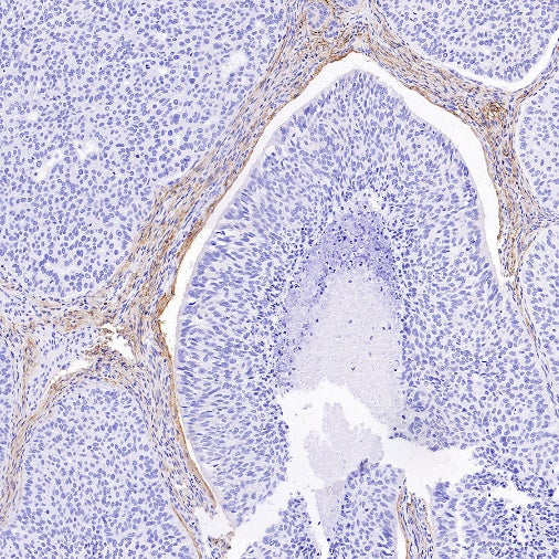 LRRC15 Recombinant Rabbit mAb (S-2473-43)
