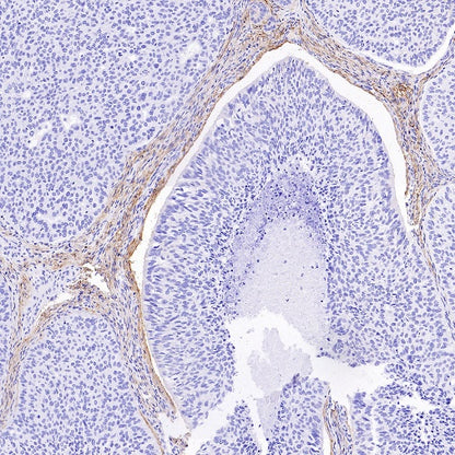 LRRC15 Recombinant Rabbit mAb (S-2473-43)