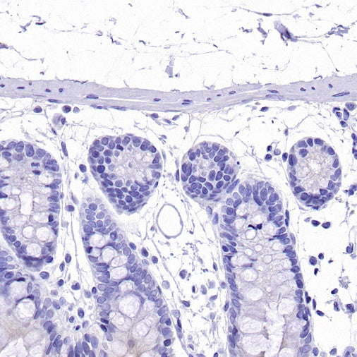 Olfm4 Recombinant Rabbit mAb (S-2748-67)