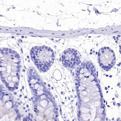 Olfm4 Recombinant Rabbit mAb (S-2748-67)