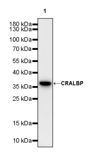 CRALBP Rabbit Polyclonal Antibody