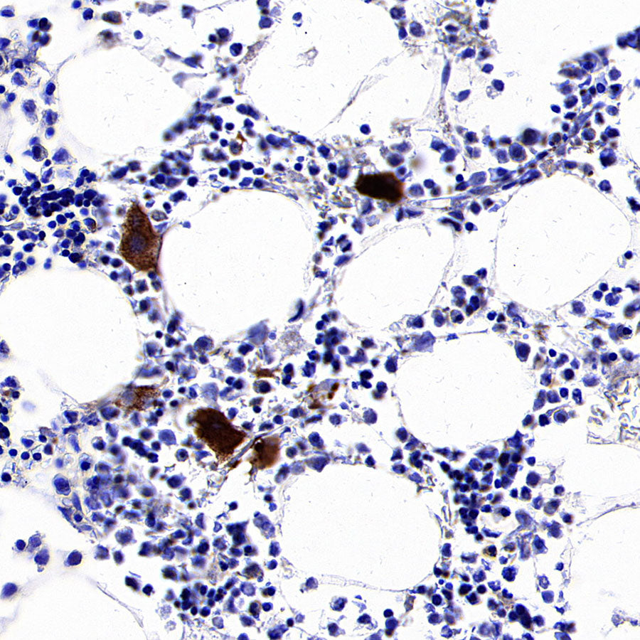 Thrombospondin 1 Recombinant Rabbit mAb (S-4153-22)
