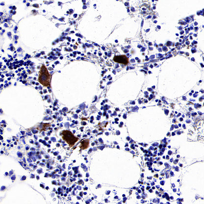 Thrombospondin 1 Recombinant Rabbit mAb (S-4153-22)