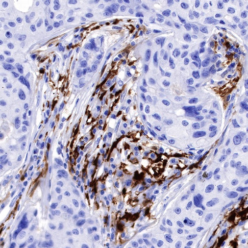 Factor XIIIa Recombinant Rabbit mAb (SDT-644-7)