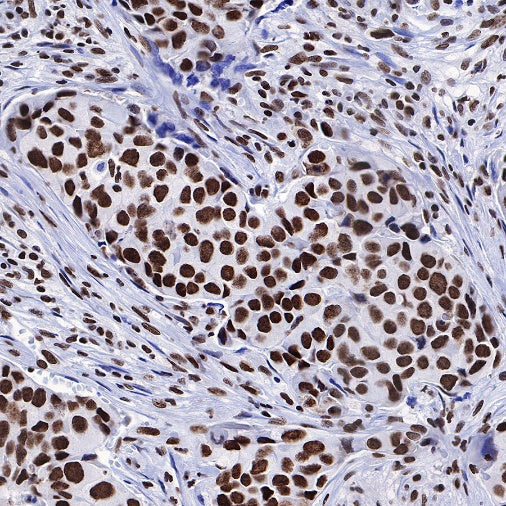 FUBP1 Recombinant Rabbit mAb (S-739-21)