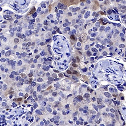 SMAD3 Recombinant Rabbit mAb (S-517-122)