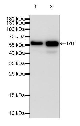 TdT Rabbit Polyclonal Antibody