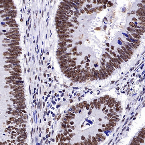 CDK9 Recombinant Rabbit mAb (S-2661-10)