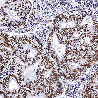 NPM1 Recombinant Rabbit mAb (S-4119-58)