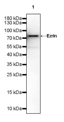 Ezrin Recombinant Rabbit mAb (S-1894-4)