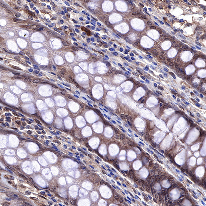 S-RMab® PTEN Recombinant Rabbit mAb (SDT-R069)