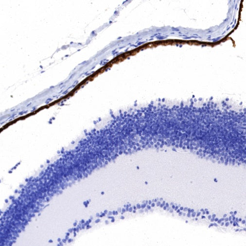 RPE65 Recombinant Rabbit mAb (S-525-124)