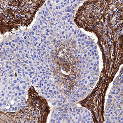 Integrin alpha 5 Recombinant Rabbit mAb (S-381-37)