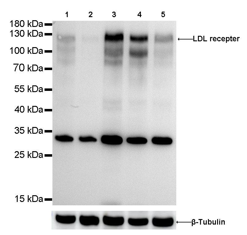 LDL receptor Recombinant Rabbit  mAb (SDT-057-57)