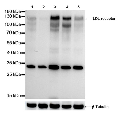 LDL receptor Recombinant Rabbit  mAb (SDT-057-57)