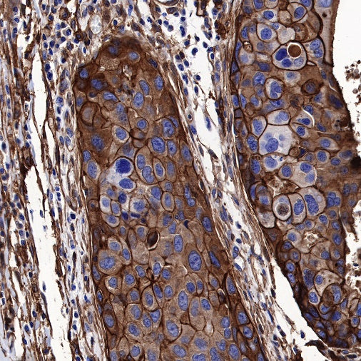 S-RMab®Annexin A2 Recombinant Rabbit mAb (SDT-444-67)
