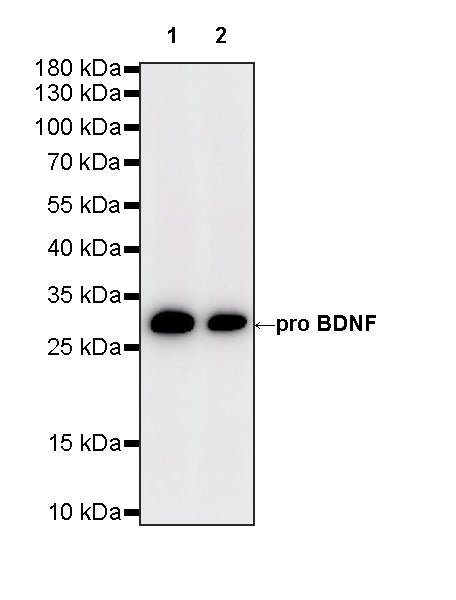 BDNF Recombinant Rabbit mAb (S-4118-38)
